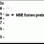 Western blot detection of NNE antibody.