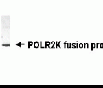 Western blot detection of POLR2K antibody.