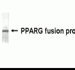 Western blot detection of PPARG antibody.