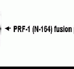 Western blot detection of PRF-1 (N-164) antibody.