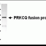 Western Blot analysis of PRKCQ antibody. E. coli-derived PRKCQ fusion protein with XW-7463 diluted 1/2000.