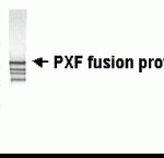 Western Blot analysis of PEX19. E. coli derived fusion protein as test antigen. XW-7504 at 1/2000. The top band (80kD) represents PEX19. The lower bands probably represent degradation products.