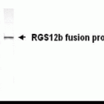 Western Blot: E coli-derived fusion protein as test antigen. XW-7522 dilution 1:2,000.
