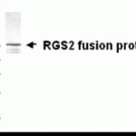 Western blot analysis of E coli derived RGS2 fusion protein using XW-7531 at 1/2000. Predicted band size : 24 kDa