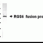 Western blot analysis of E coli derived RGS6 fusion protein using XW-7535 at 1/2000.