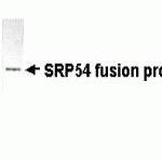 Western blot analysis of E coli derived SRP54 fusion protein using XW-7589 at 1:2,000.