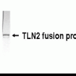 Western Blot: XW-7621 dilution: 1:2,000. Goat anti-GTX14274 HRP dilution 1:1,000. E coli-derived fusion protein as test antigen.