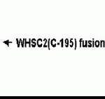Western Blot: E coli derived fusion protein as test antigen. XW-7655 dilution: 1:2000. Colorimetric method for signal development.