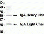 Human plasma protein as test antigen. Affinity-purified IgY dilution: 1:500, Goat anti-IgY-HRP dilution: 1:1000. Colorimetric method for signal development.