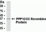E coli-derived recombinant protein as test antigen. Affinity-purified IgY dilution: 1:2000, Goat anti-IgY-HRP dilution: 1:1000. Colorimetric method for signal development.