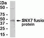 E coli-derived fusion protein as test antigen. Affinity-purified IgY dilution: 1:2000, Goat anti-IgY-HRP dilution: 1:1000. Colorimetric method for signal development.