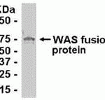 E coli-derived fusion protein as test antigen. Affinity-purified IgY dilution: 1:2000, Goat anti-IgY-HRP dilution: 1:1000. Colorimetric method for signal development.