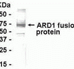 E coli-derived fusion protein as test antigen. Affinity-purified IgY dilution: 1:2000, Goat anti-IgY-HRP dilution: 1:1000. Colorimetric method for signal development.