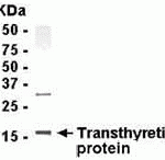Human plasma protein as test antigen. Affi-pure IgY as primary antibody and Goat-anti-IgY-HRP as 2nd antibody. Fixed amount of Ab (1 ug/mL) and serial dilutions of Ag. E coli-derived fusion protein as test antigen. Affinity-purified IgY dilution: 1:2000, Goat anti-IgY-HRP dilution: 1:1000. Colorimetric method for signal development.