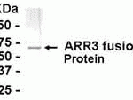E coli-derived fusion protein as test antigen. Affinity-purified IgY dilution: 1:2000, Goat anti-IgY-HRP dilution: 1:1000. Colorimetric method for signal development.