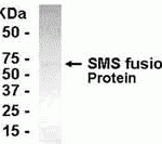 E coli-derived fusion protein as test antigen. Affinity-purified IgY dilution: 1:2000, Goat anti-IgY-HRP dilution: 1:1000. Colorimetric method for signal development.