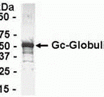 Human plasma Gc-Globulin protein as test antigen. Affi-pure anti-Gc-Globulin IgY as primary antibody (1.0 ug/mL), and Rabbit anti-IgY-HRP as 2nd antibody. Plasma protein as test antigen. Affinity-purified IgY dilution: 1:2000, Goat anti-IgY-HRP dilution: 1:1000. Colorimetric method for signal development.