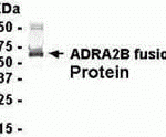 E coli-derived fusion protein as test antigen. Affinity-purified IgY dilution: 1:2000, Goat anti-IgY-HRP dilution: 1:1000. Colorimetric method for signal development.