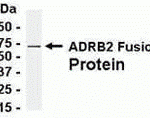 E coli-derived fusion protein as test antigen. Affi-pure IgY dilution: 1:2000, Goat anti-IgY-HRP dilution: 1:1000. Colorimetric method for signal development.