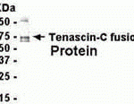 E coli-derived fusion protein as test antigen. Affinity-purified IgY dilution: 1:2000, Goat anti-IgY-HRP dilution: 1:1000. Colorimetric method for signal development.