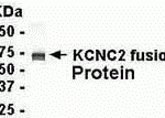 E coli-derived fusion protein as test antigen. Affinity-purified IgY dilution: 1:2000, Goat anti-IgY-HRP dilution: 1:1000. Colorimetric method for signal development.