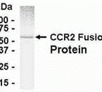 E coli-derived fusion protein as test antigen. Affinity-purified IgY dilution: 1:1000, Goat anti-IgY-HRP dilution: 1:1000. Colorimetric method for signal development.