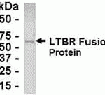 E coli-derived fusion protein as test antigen. Affinity-purified IgY dilution: 1:2000, Goat anti-IgY-HRP dilution: 1:1000. Colorimetric method for signal development.