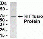 E coli-derived fusion protein as test antigen. Affinity-purified IgY dilution: 1:2000, Goat anti-IgY-HRP dilution: 1:1000. Colorimetric method for signal development.