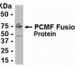 E coli-derived fusion protein as test antigen. Affinity-purified IgY dilution: 1:2000, Goat anti-IgY-HRP dilution: 1:1000. Colorimetric method for signal development.