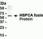 E coli-derived fusion protein as test antigen. Affinity-purified IgY dilution: 1:2000, Goat anti-IgY-HRP dilution: 1:1000. Colorimetric method for signal development.