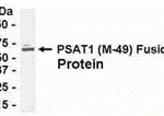 E coli-derived fusion protein as test antigen. Affinity-purified IgY dilution: 1:2000, Goat anti-IgY-HRP dilution: 1:1000. Colorimetric method for signal development.