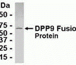 E coli-derived fusion protein as test antigen. Affinity-purified IgY dilution: 1:2000, Goat anti-IgY-HRP dilution: 1:1000. Colorimetric method for signal development.