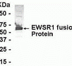 E coli-derived fusion protein as test antigen. Affinity-purified IgY dilution: 1:2000, Goat anti-IgY-HRP dilution: 1:1000. Colorimetric method for signal development.