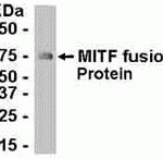 E coli-derived fusion protein as test antigen. Affinity-purified IgY dilution: 1:2000, Goat anti-IgY-HRP dilution: 1:1000. Colorimetric method for signal development.