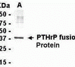 E coli-derived fusion protein as test antigen. Affinity-Purified IgY dilution: 1:2000, Goat anti-IgY-HRP dilution: 1:1000. Colorimetric method for signal development.