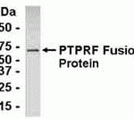 E coli-derived fusion protein as test antigen. Affinity-purified IgY dilution: 1:2000, Goat anti-IgY-HRP dilution: 1:1000. Colorimetric method for signal development.
