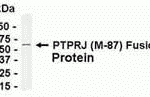 E coli-derived fusion protein as test antigen. Affinity-purified IgY dilution: 1:2000, Goat anti-IgY-HRP dilution: 1:1000. Colorimetric method for signal development.
