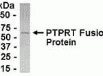 E coli-derived fusion protein as test antigen. Affinity-purified IgY dilution: 1:2000, Goat anti-IgY-HRP dilution: 1:1000. Colorimetric method for signal development.