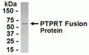 PTPN1 Antibody