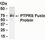 E coli-derived fusion protein as test antigen. Affinity-purified IgY dilution: 1:2000, Goat anti-IgY-HRP dilution: 1:1000. Colorimetric method for signal development.