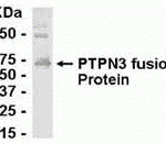 E coli-derived fusion protein as test antigen. Affinity-purified IgY dilution: 1:2000, Goat anti-IgY-HRP dilution: 1:1000. Colorimetric method for signal development.