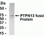 E coli-derived fusion protein as test antigen. Affinity-purified IgY dilution: 1:2000, Goat anti-IgY-HRP dilution: 1:1000. Colorimetric method for signal development.