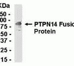 E coli-derived fusion protein as test antigen. Affinity-purified IgY dilution: 1:2000, Goat anti-IgY-HRP dilution: 1:1000. Colorimetric method for signal development.