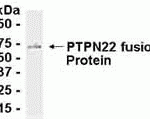 E coli-derived fusion protein as test antigen. Affinity-purified IgY dilution: 1:2000, Goat anti-IgY-HRP dilution: 1:1000. Colorimetric method for signal development.