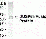 E coli-derived fusion protein as test antigen. Affinity-purified IgY dilution: 1:1000, Goat anti-IgY-HRP dilution: 1:1000. Colorimetric method for signal development.