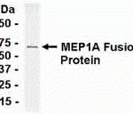 E coli-derived fusion protein as test antigen. Affinity-purified IgY dilution: 1:2000, Goat anti-IgY-HRP dilution: 1:1000. Colorimetric method for signal development.