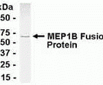 E coli-derived fusion protein as test antigen. Affinity-purified IgY dilution: 1:2000, Goat anti-IgY-HRP dilution: 1:1000. Colorimetric method for signal development.