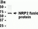 E coli-derived fusion protein as test antigen. Affinity-purified IgY dilution: 1:2000, Goat anti-IgY-HRP dilution: 1:1000. Colorimetric method for signal development.