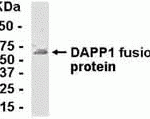 E coli-derived fusion protein as test antigen. Affinity-purified IgY dilution: 1:2000, Goat anti-IgY-HRP dilution: 1:1000. Colorimetric method for signal development.