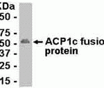 E coli-derived fusion protein as test antigen. Affinity-purified IgY dilution: 1:2000, Goat anti-IgY-HRP dilution: 1:1000. Colorimetric method for signal development.
